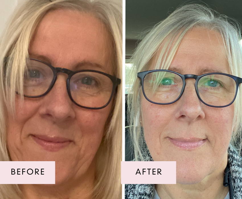 Before and after photos of a mature woman wearing glasses, showing smoother skin, reduced fine lines, and a brighter complexion after using Raw Beauty Lab’s Vegan Collagen.