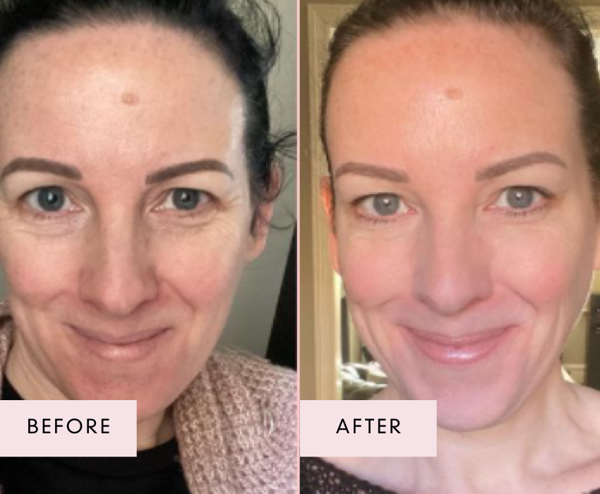 Before and after photos of a woman with fair skin, showing visibly reduced wrinkles, smoother texture, and a radiant glow after using Raw Beauty Lab’s Vegan Collagen.