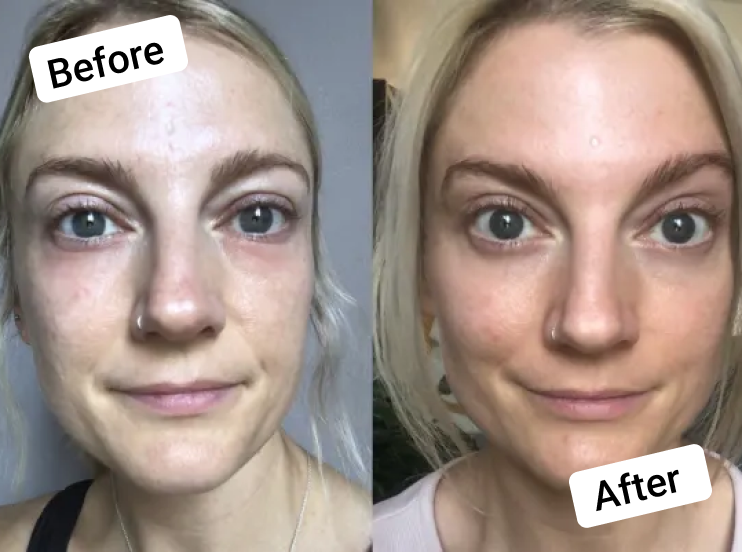 Vegan Collagen before and after