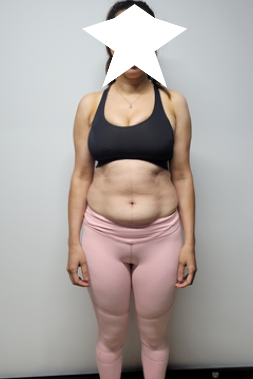 Weight loss results before picture female