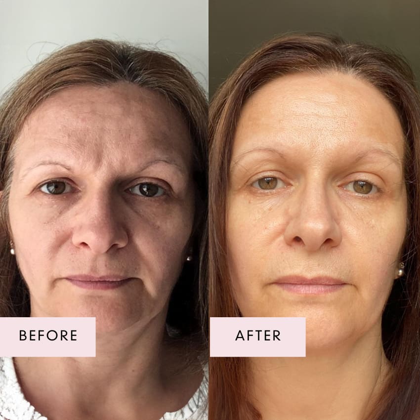 Before and after image of a woman showing firmer skin, improved hydration, and reduced signs of fatigue after using Vegan Collagen Luxe