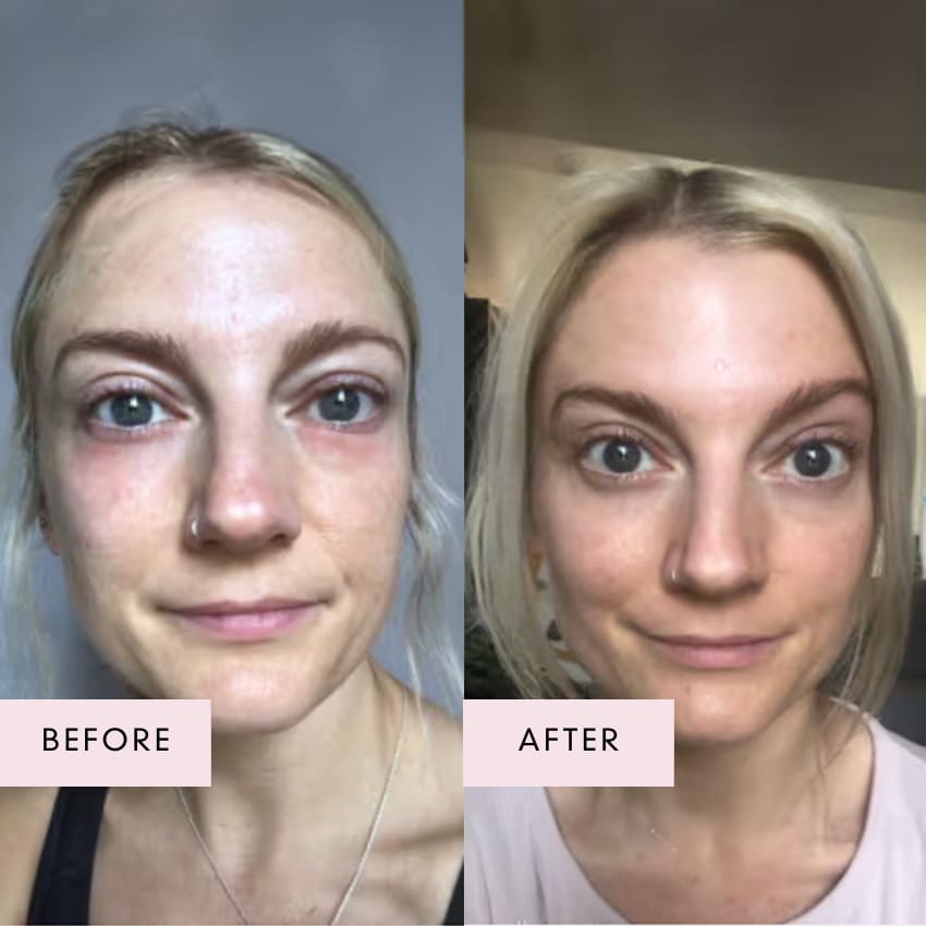 Before and after photo of a woman showing more radiant, even-toned skin and reduced redness after using Vegan Collagen Luxe