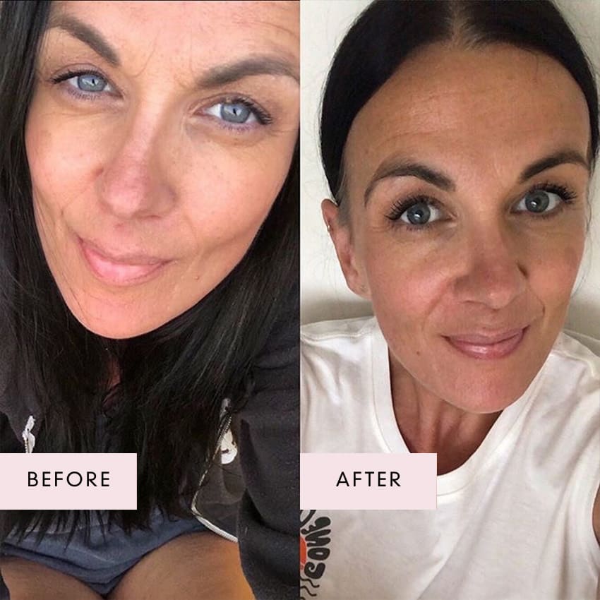 Before and after image of a woman showing brighter, smoother skin and reduced signs of fatigue after using Vegan Collagen Luxe