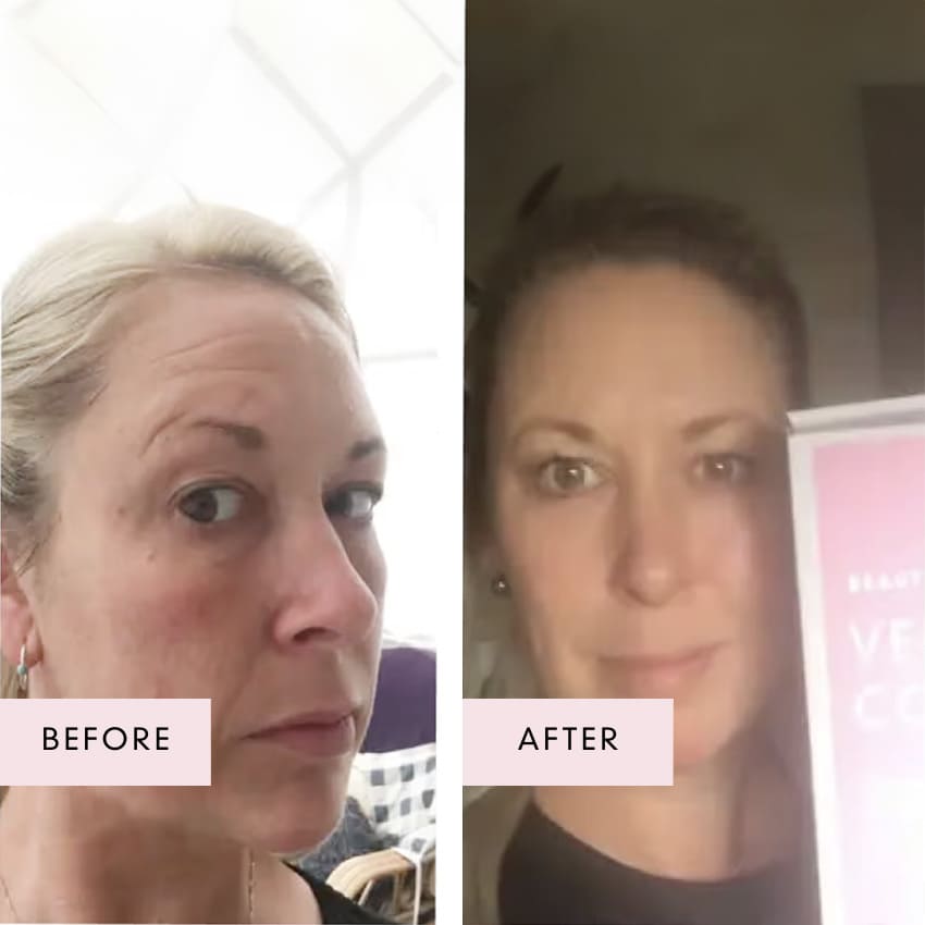 Before and after comparison of a woman’s face showing improved skin tone and reduced fine lines after using Vegan Collagen Luxe