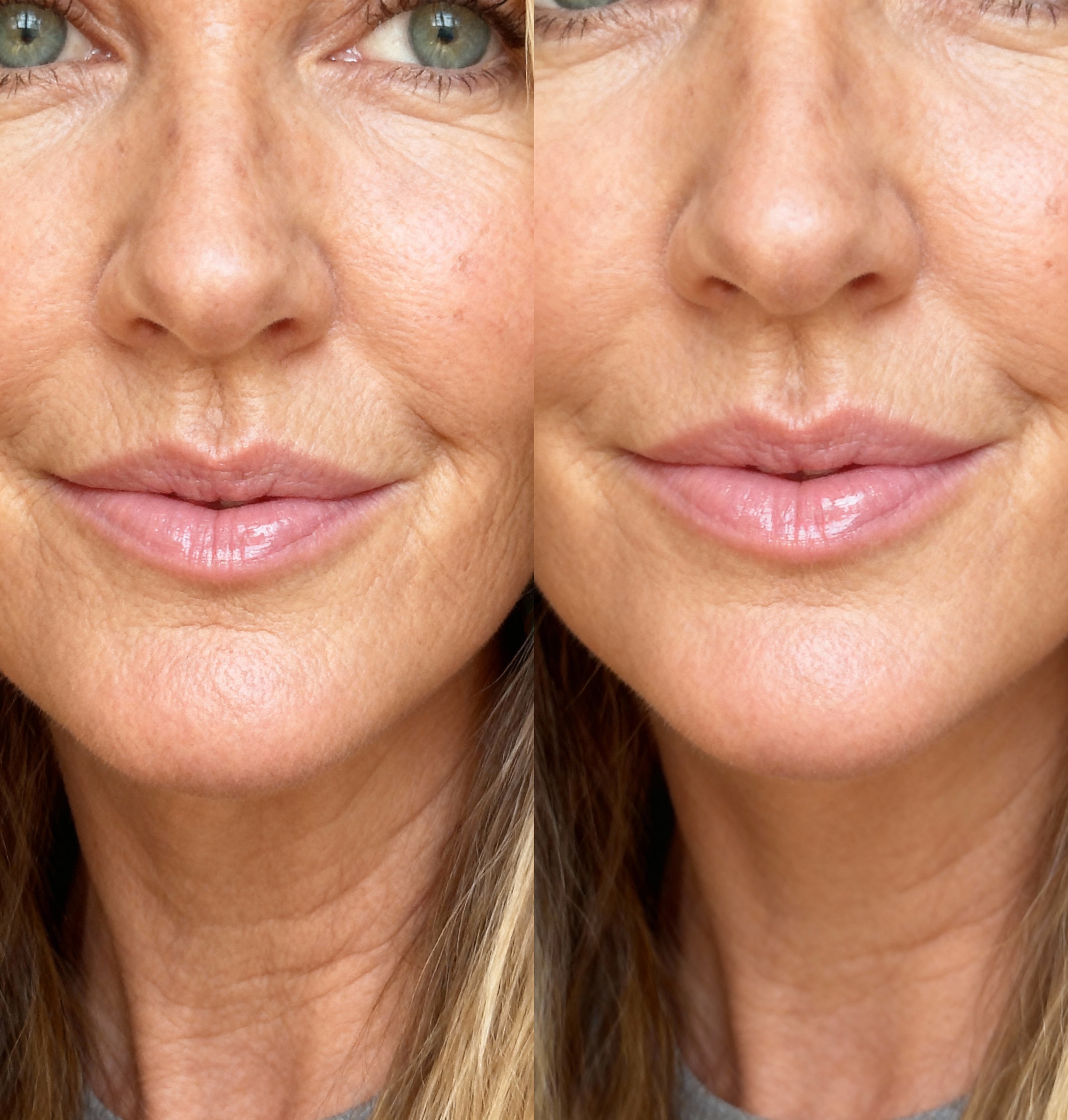 Close-up of a woman's face before and after vegan collagen from raw beauty lab, showing visible differences.