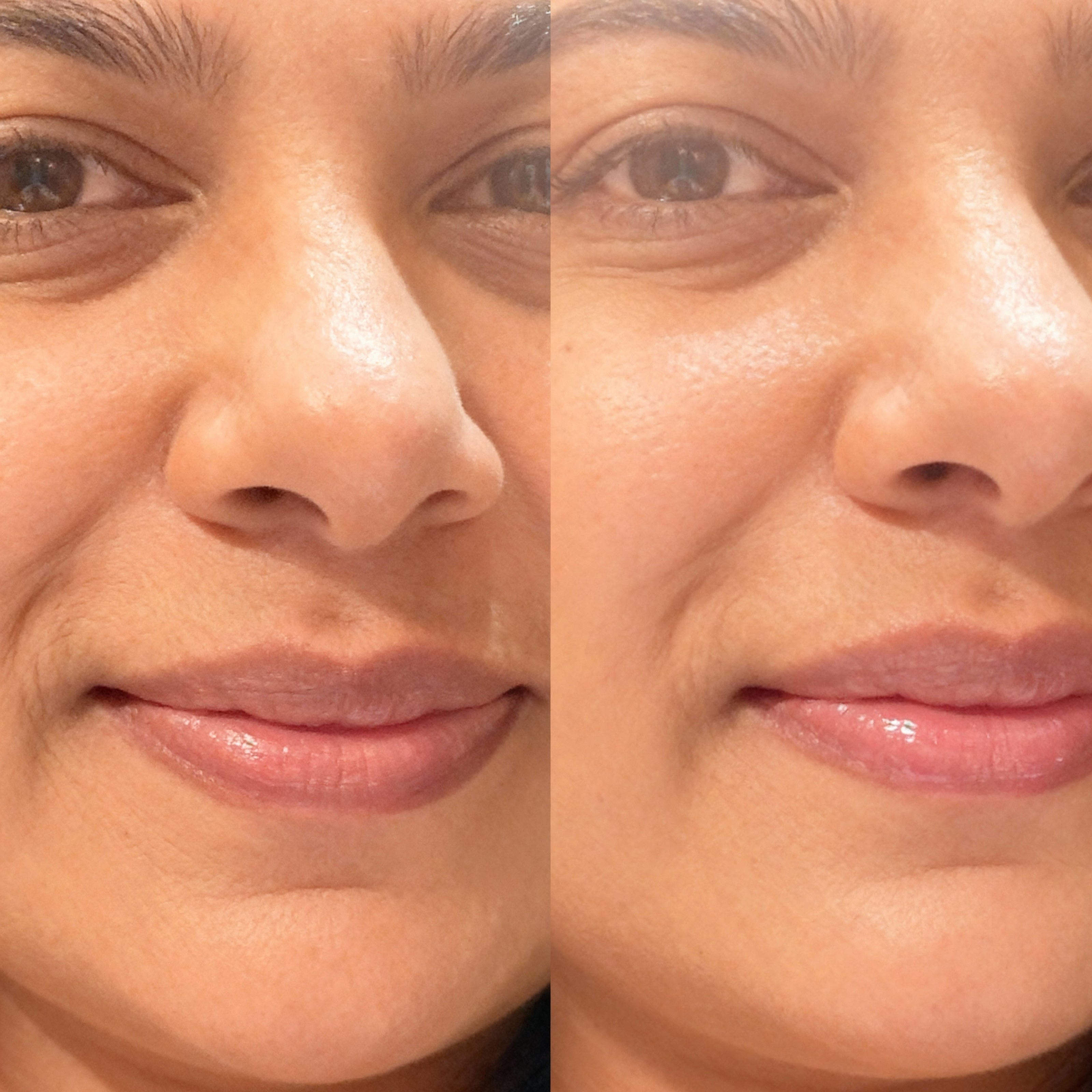 Side-by-side comparison of a woman's face with and without makeup and fine line improvements after using vegan collagen from Raw Beauty Lab