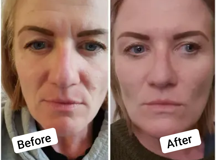 Raw Beauty Lab Vegan Collagen Before and After