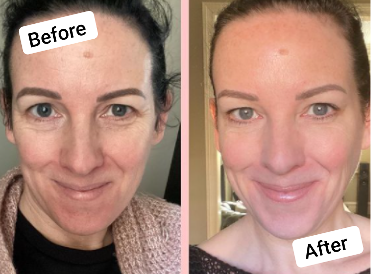 Skin before and after with vegan collagen 