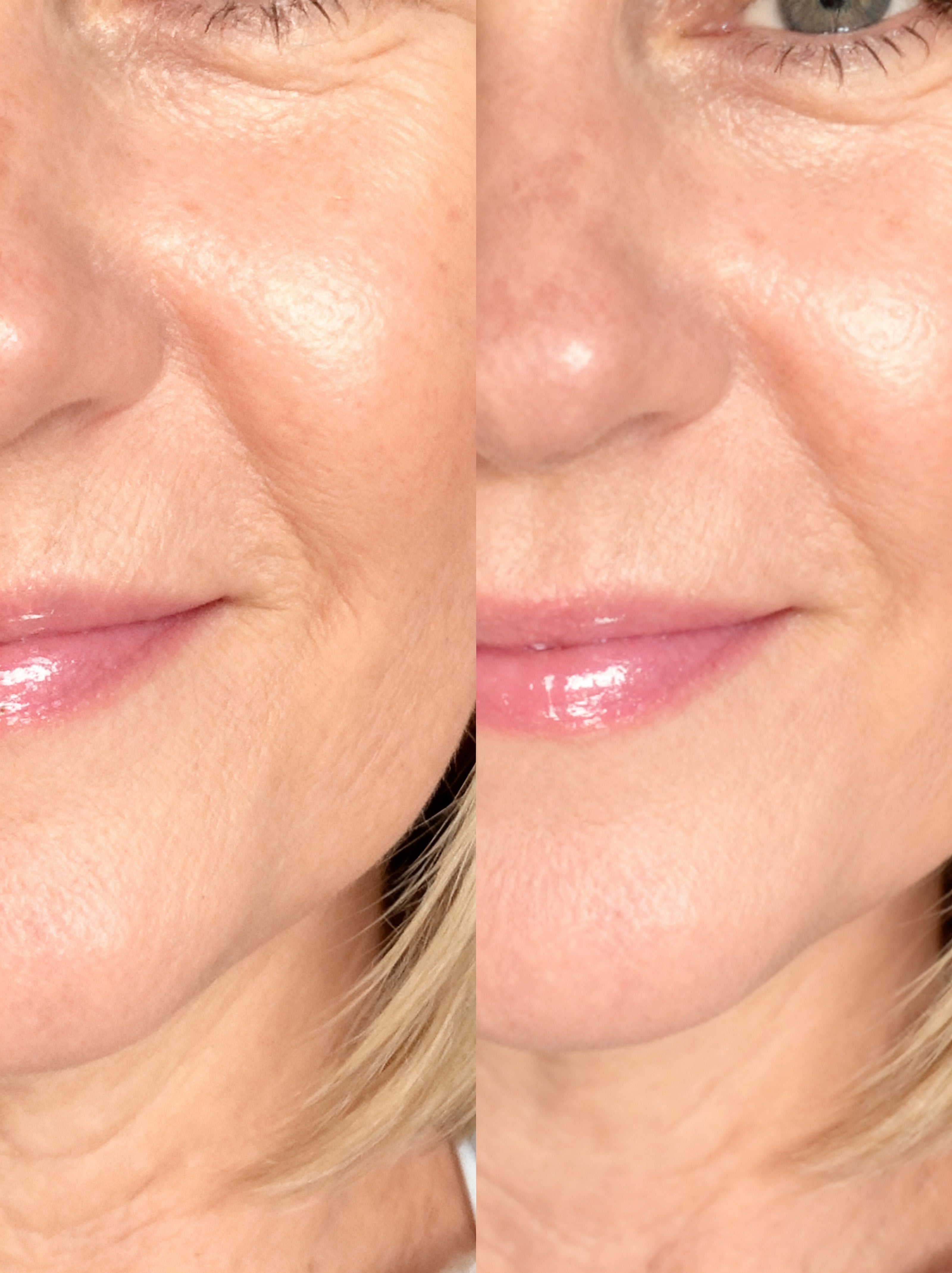 Before and after comparison of a woman's face with visible skin texture differences after using vegan collagen from raw beauty lab