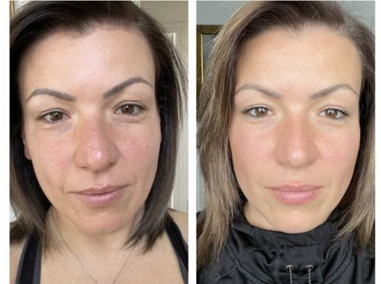 Vegan Collagen Before and After