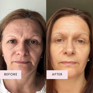 Amanda before and after taking Vegan Collagen