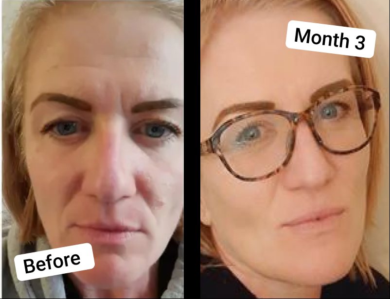 Detelina before and after three months of taking Vegan Collagen